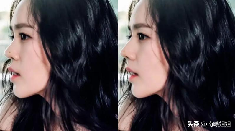 蒜头鼻却很漂亮的原因,蒜头鼻是真的影响颜值