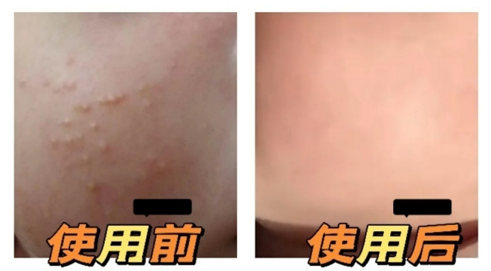 宝宝润肤乳成分安全又好用,宝宝润肤乳秋冬防皴