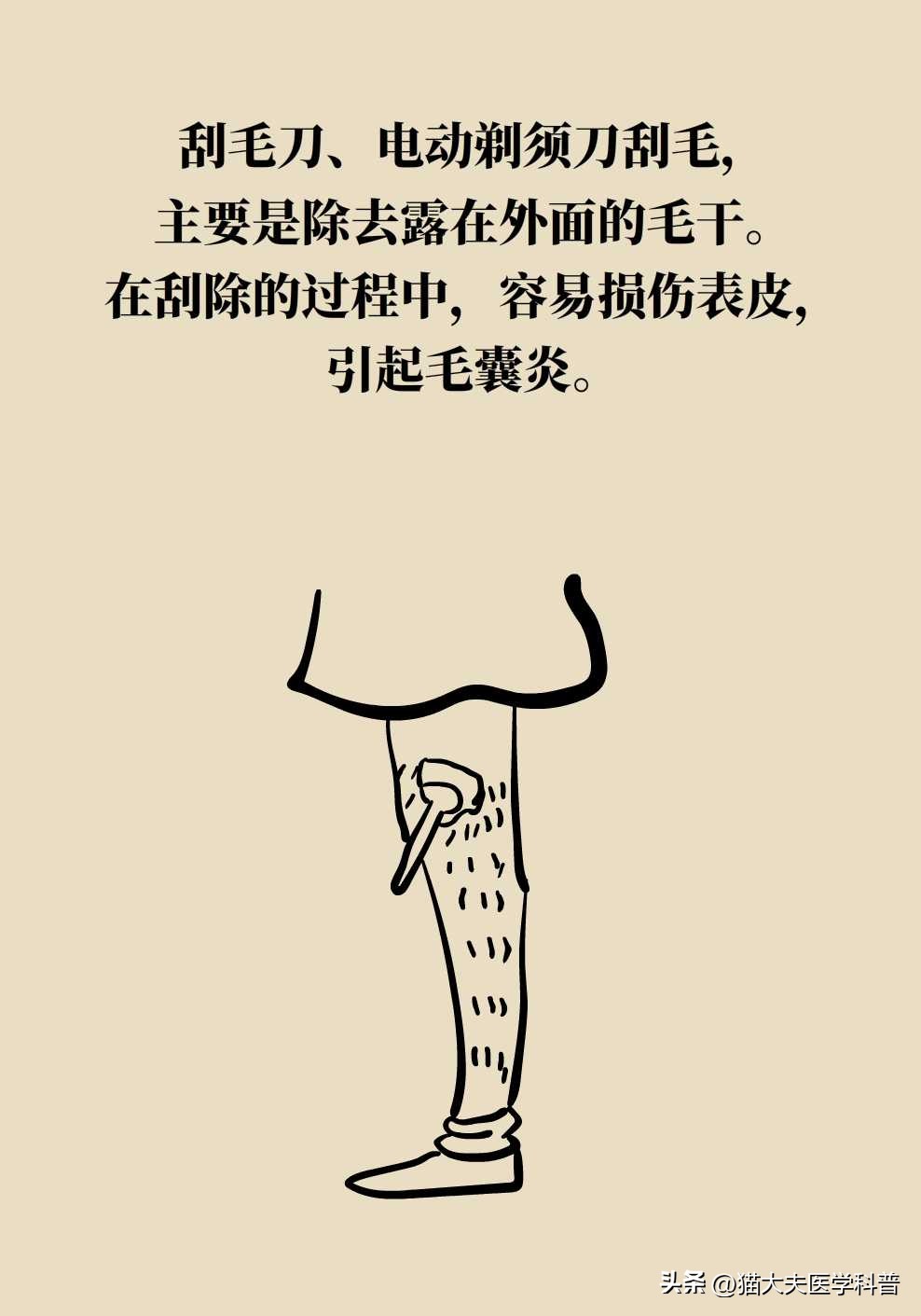 激光永久脱毛一般多少钱,永久激光脱毛是不是骗人的