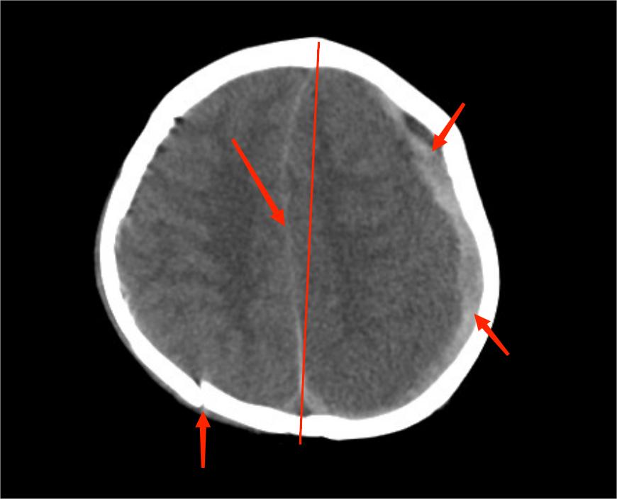 50厘米高,50厘米身高