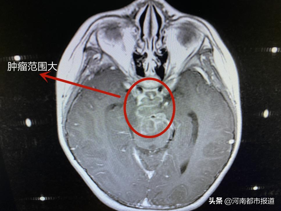 晴天霹雳神童,晴天霹雳儿童