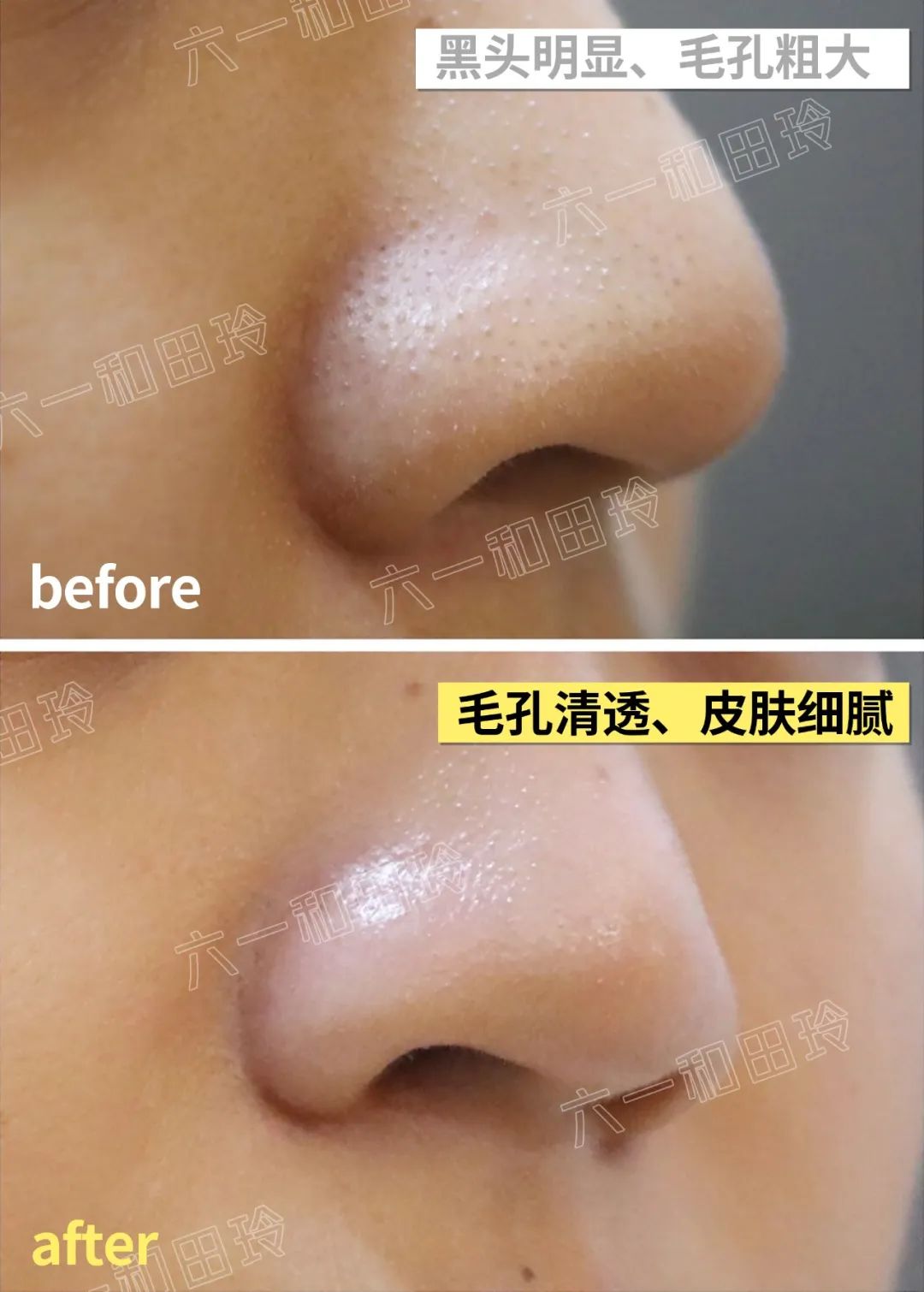 各种酸的用途及使用方法,各种酸的种类及不同的功效