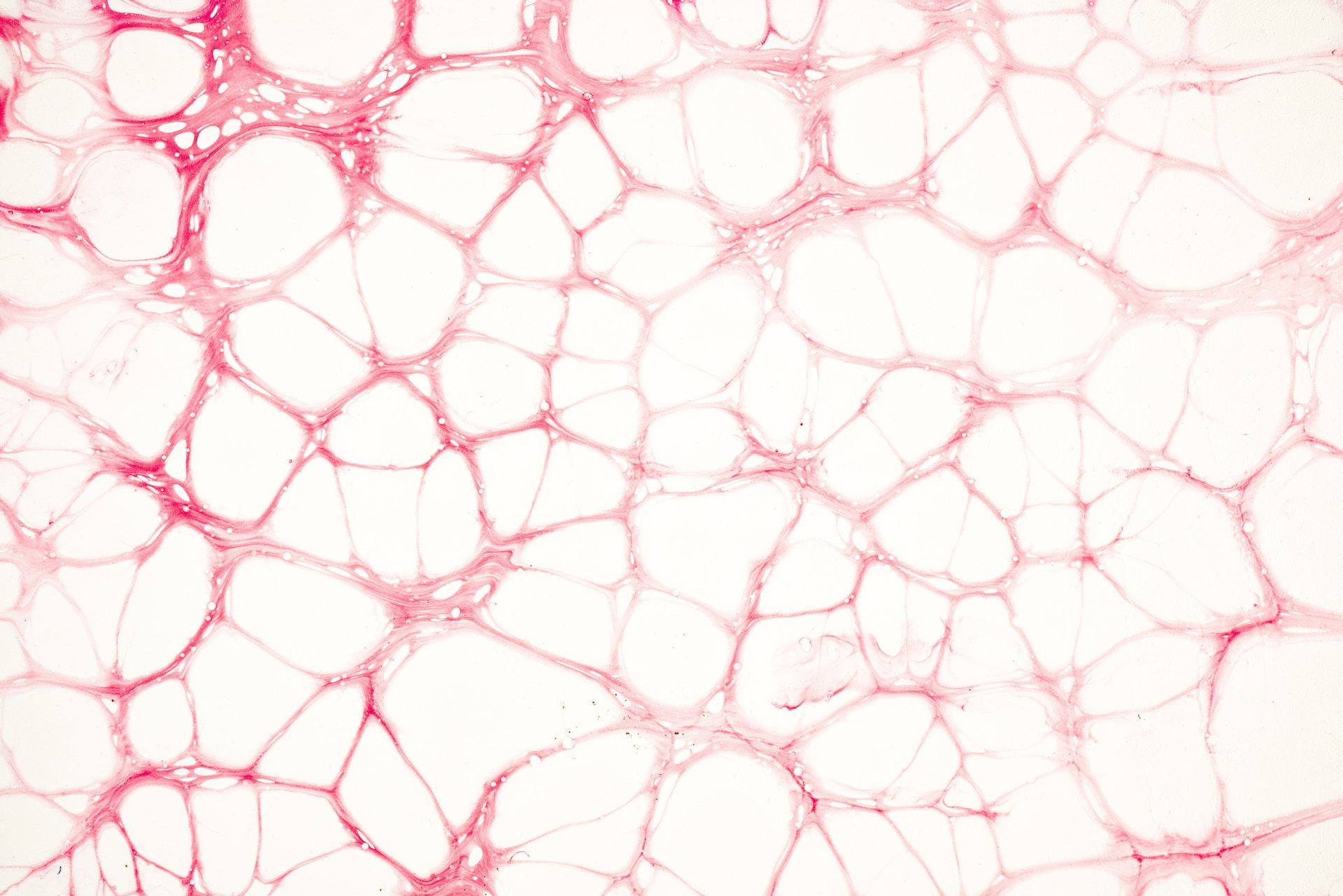 中暑头晕恶心教你一招解决方法,轻微中暑是反胃恶心的症状吗