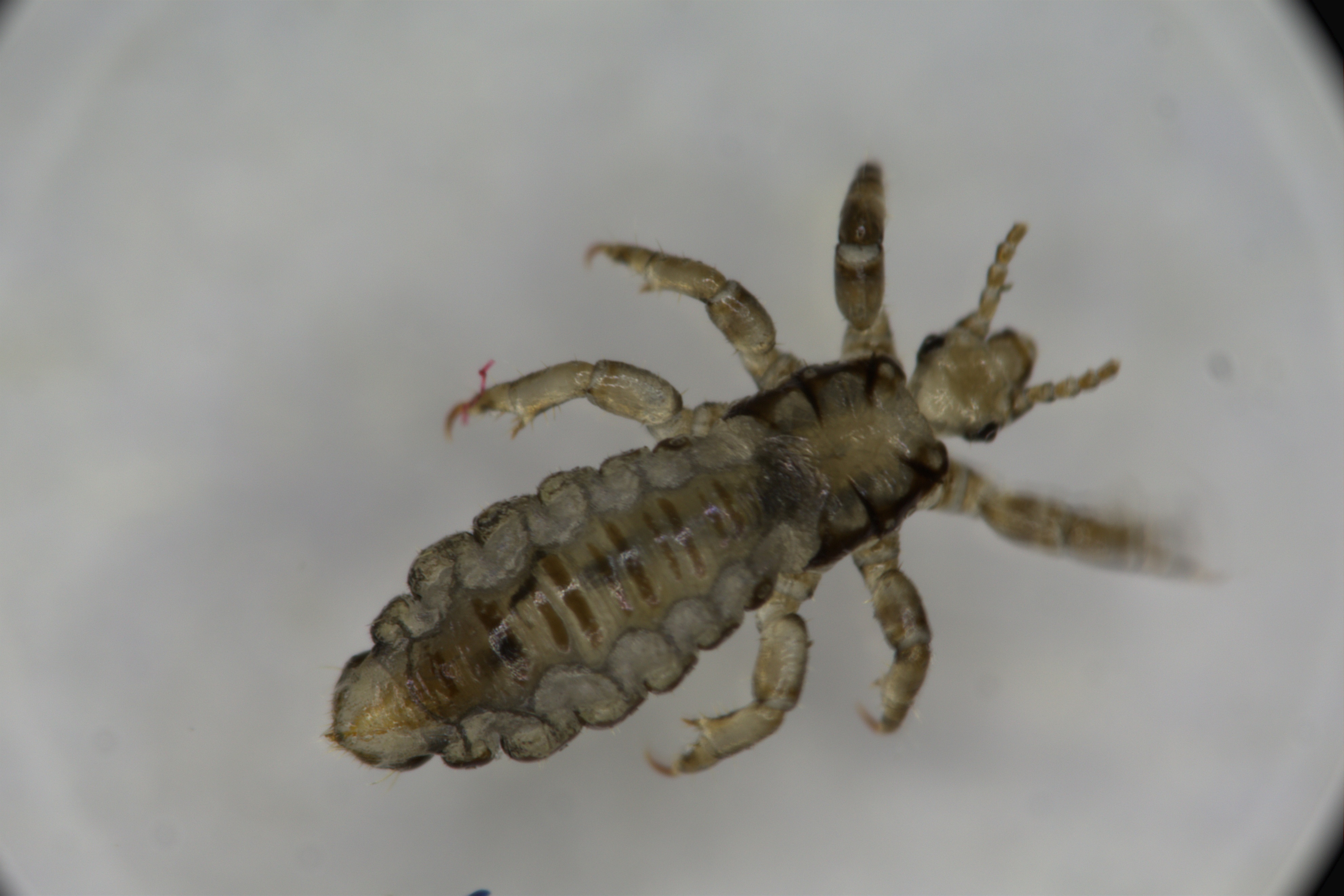 七岁孩子头发上怎么长虱子,小孩头发长头屑虱子