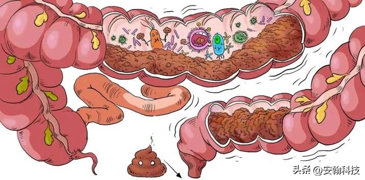 安翰科技磁控胶囊胃镜怎么检查,安翰磁控胶囊胃镜能检查清楚吗