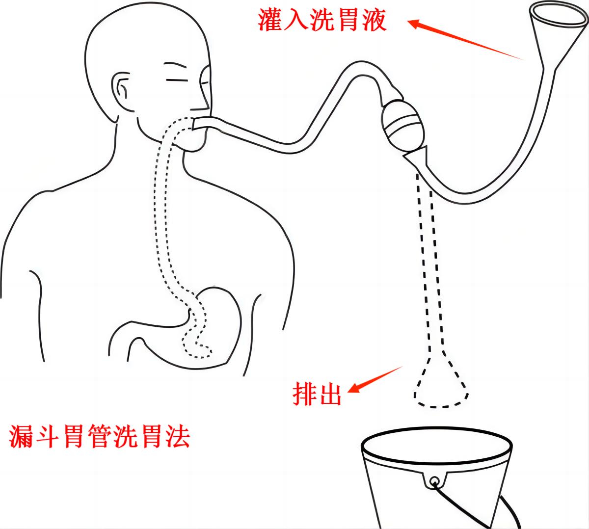 用虹吸原理排厕所水,厕所虹吸排水什么原理