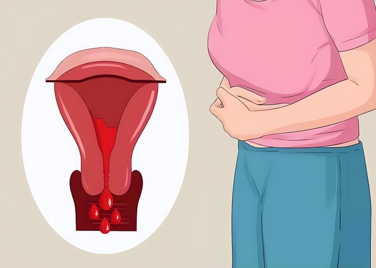 女生来例假时，突然流出的一股血块，是身上的肉吗？看完涨知识了