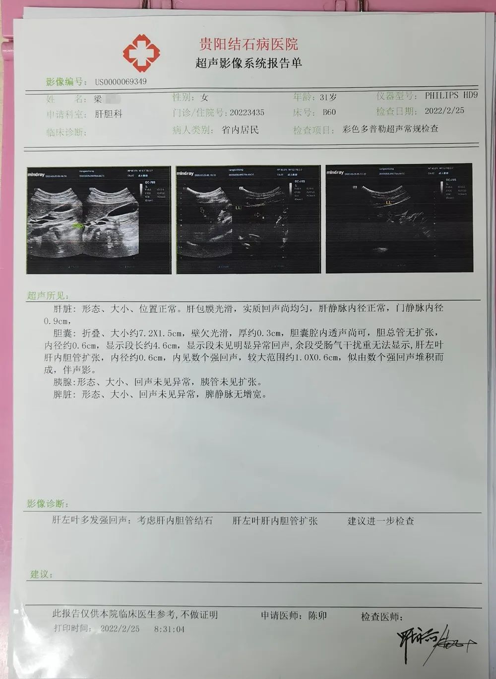 4厘米的胆结石能做保胆手术吗,胆结石多大需要做手术保胆取石