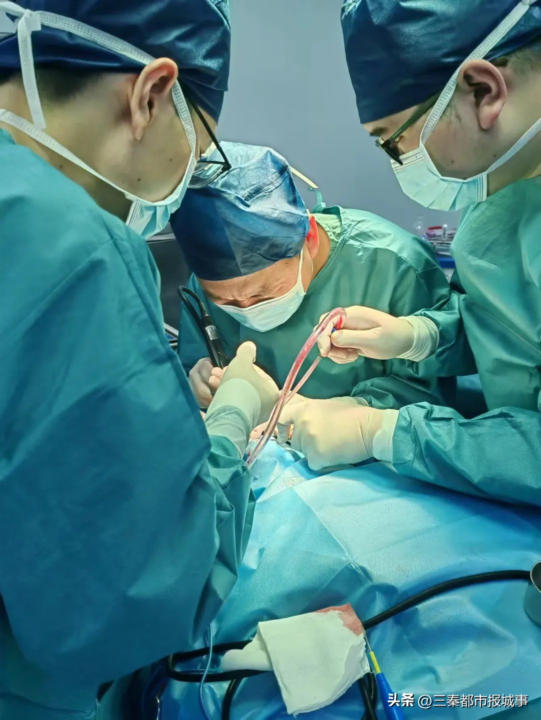 宝鸡市眼科医院手术,宝鸡市人民医院眼科手术