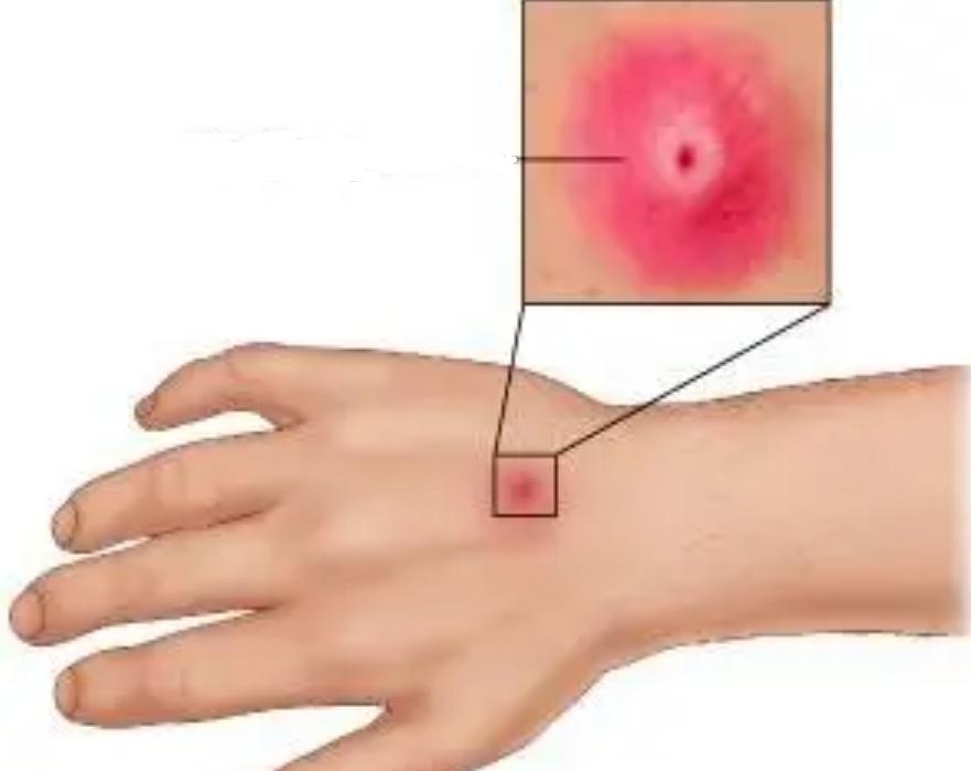 每年杀死人类最多的五种动物,每年杀人最多的六种动物