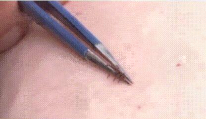 非常小的虫子爬到身上会溃烂,很小的虫子从土里爬出来