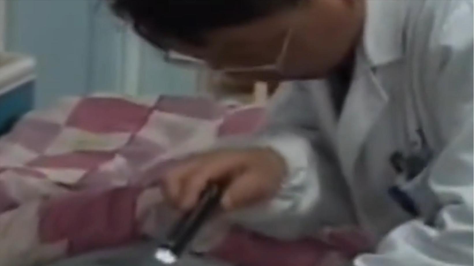 云南男子口臭手术后现在怎么样了,云南男子口臭查出了大毛病