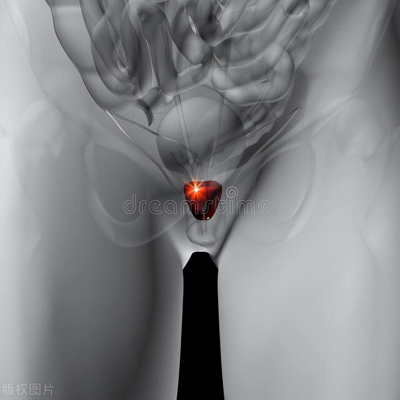 男性不要让*裤内**“陪你到老”,提醒:3个原因,男女都要了解