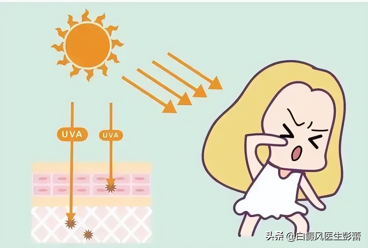 白癜风做光疗后白斑周围变黑,白癜风光疗白斑变粉红色还抹药吗