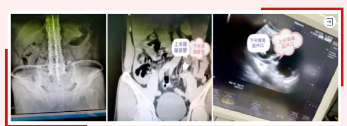 致敬每一位在抗疫一线的工作人员,致敬每一位奋斗在前线的医护人员