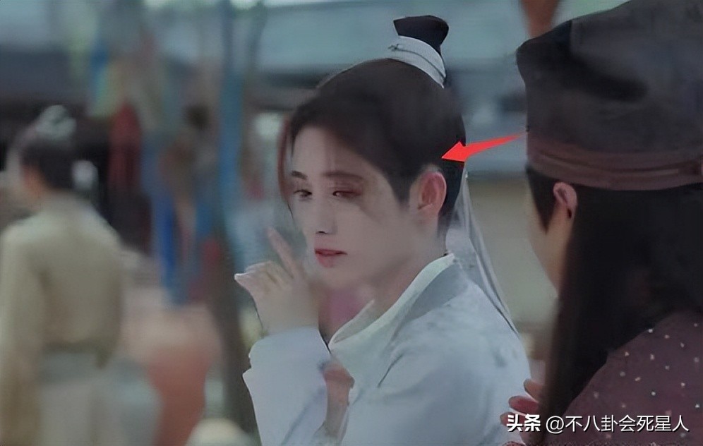 假双眼皮的明星,明星的假脸