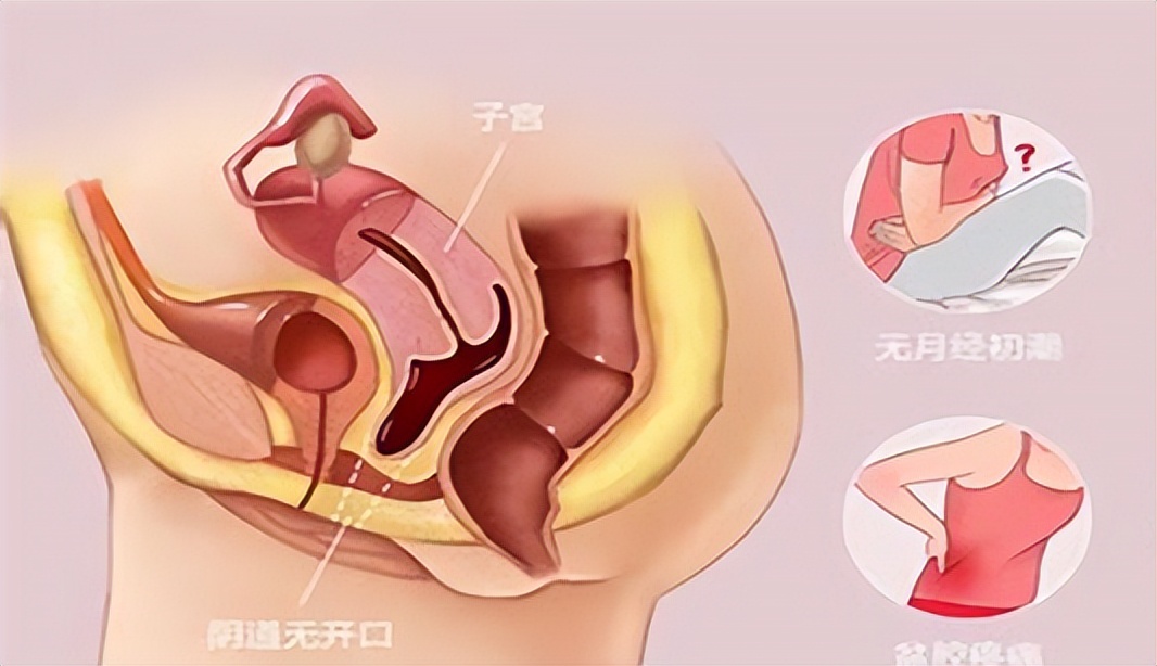 一个女性没有子宫会怎样,一个女性没有子宫会怎么样