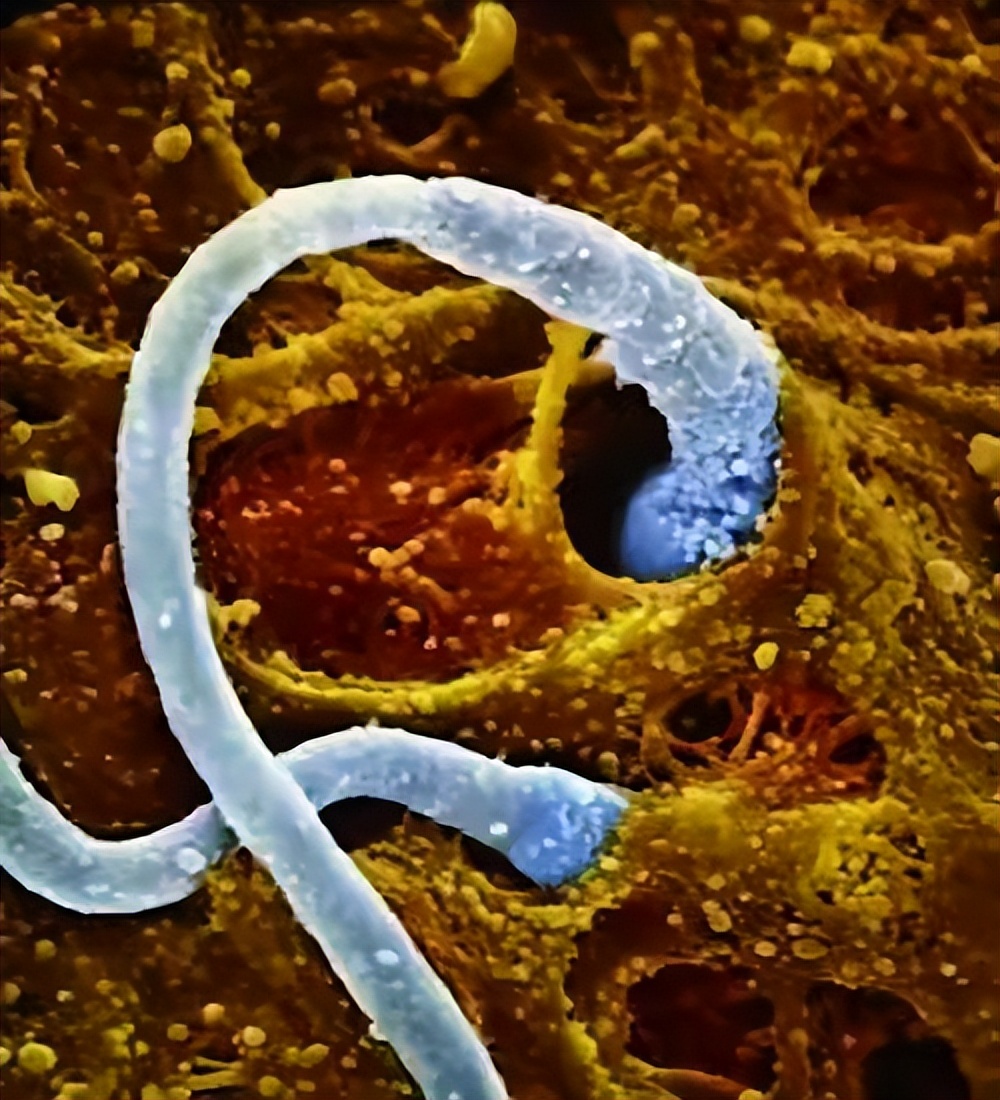 跑得最快、最阳刚的精子才能和卵子结合？不！只是运气爆棚而已