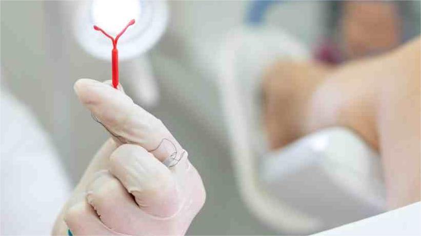 节育环在女性体内会发生哪些变化,女性节育环多少年必须取出来
