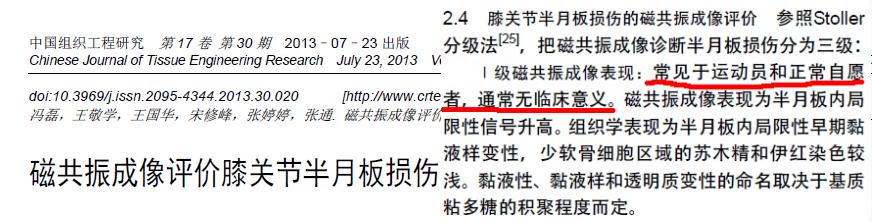 半月板损伤严重的状态是什么,半月板损伤应该注意什么问题
