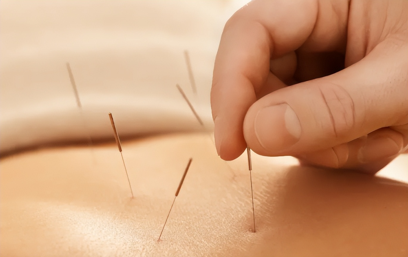 鼻咽炎三伏贴贴哪些穴位,三伏贴耳鼻喉疾病该贴哪