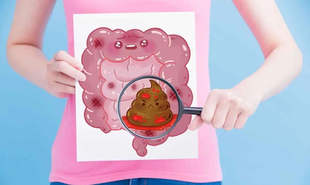 直肠癌放疗期间便血正常吗,直肠癌放疗后便血的原因是什么