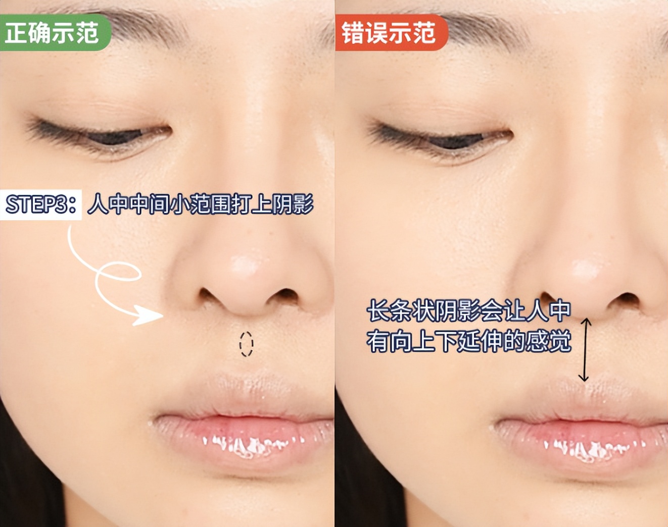 人中缩短修复,人中长显老怎么改善