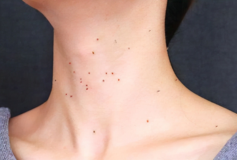 女人3个地方痒，可能不是过敏，或是这个原因有关