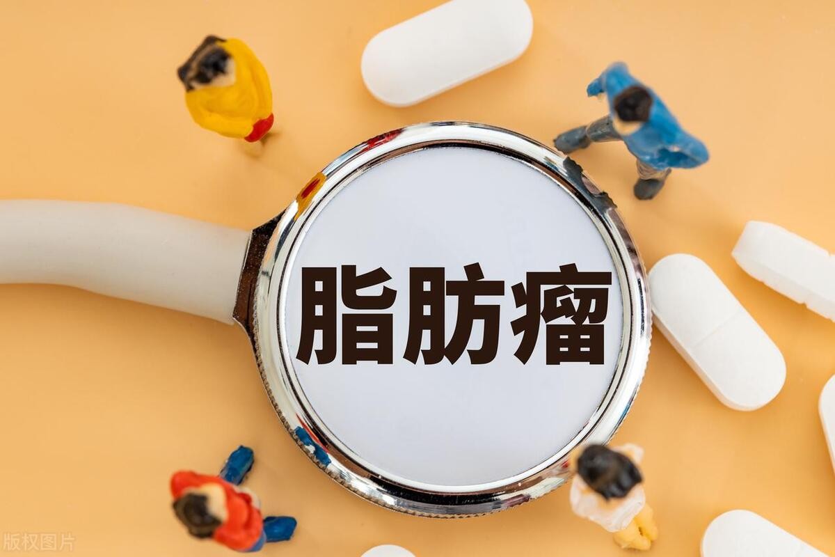 脂肪瘤中医消除最快方法最简单,中医消除脂肪瘤最好的绝招