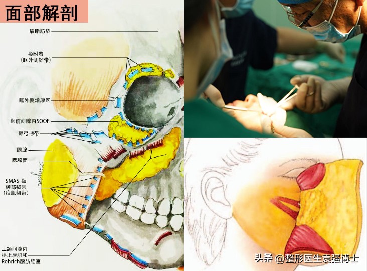 千万不要做线雕鼻后悔一辈子,不要做线雕