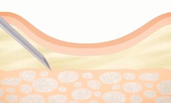 扁平脸淡颜变美思路,苦相女生长相怎么微调