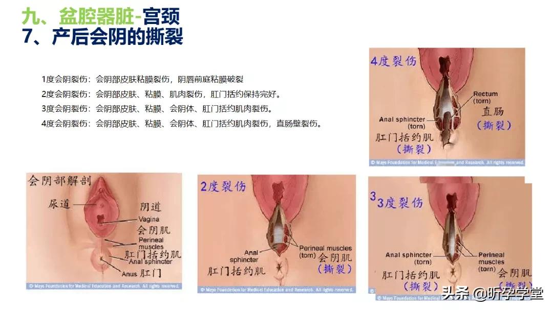 拓新提升|盆底肌健康管理，2022高级孕产瑜伽导师进修的必选课程