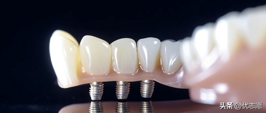 专科新能源汽车技术专业就业前景,专科美术生最好就业的专业是什么