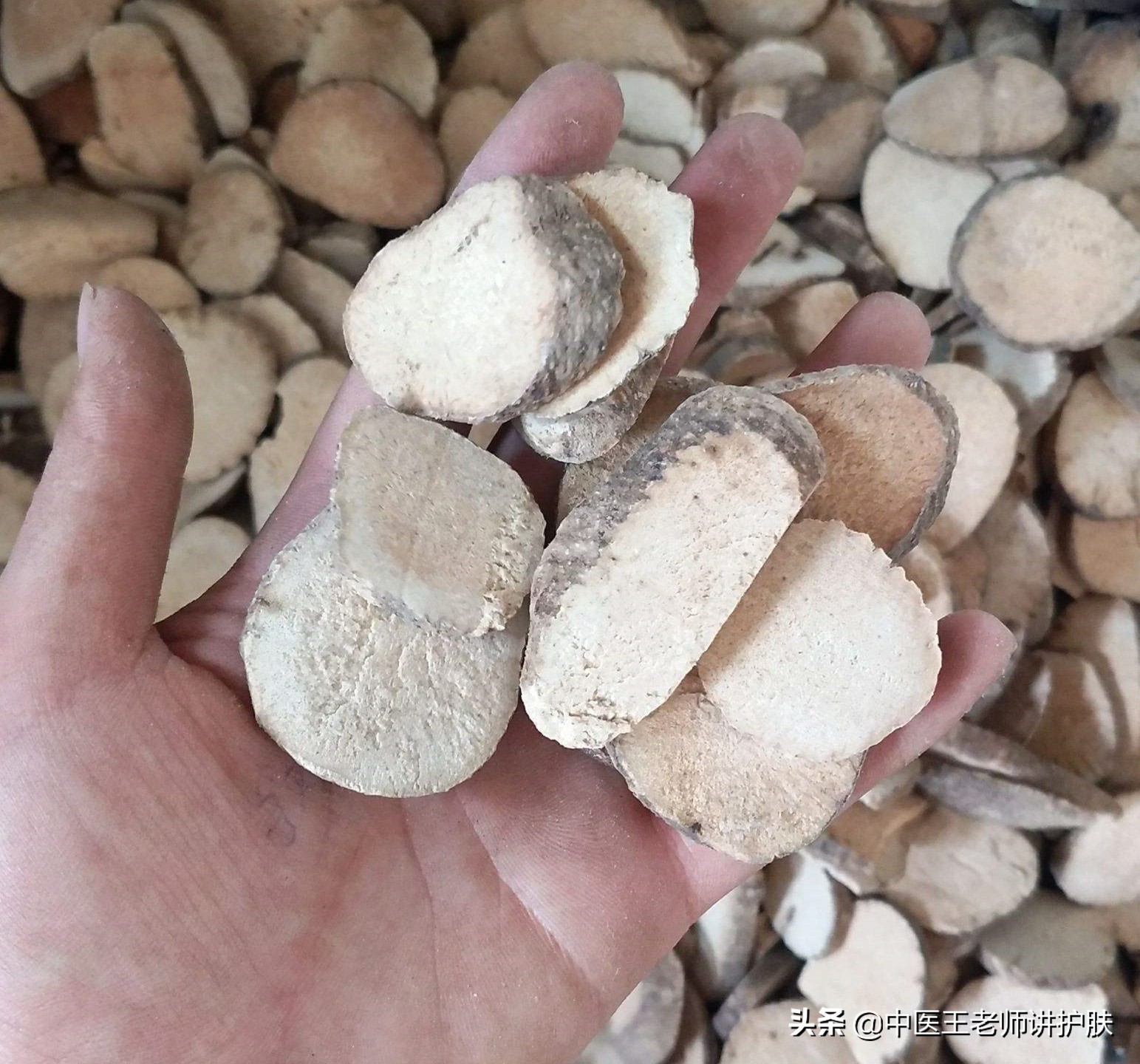 女性脂溢性脱发补肝肾气血有用吗,脂溢性脱发为什么祛风活络