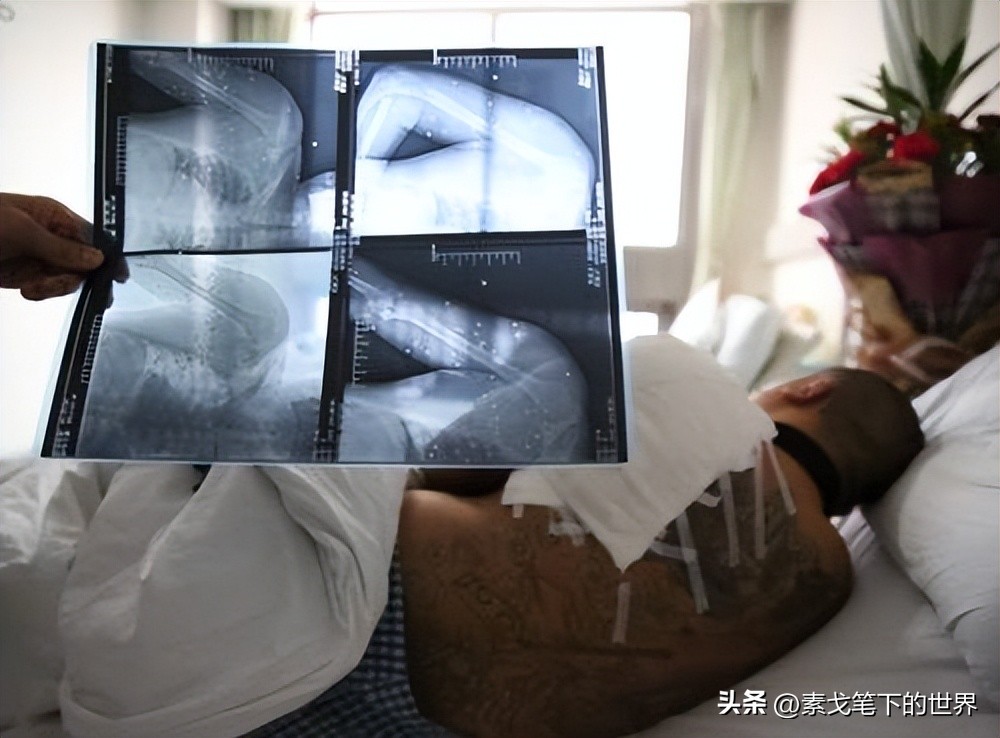 村民夜钓疑被当成野猪,江西夜钓被当野猪打