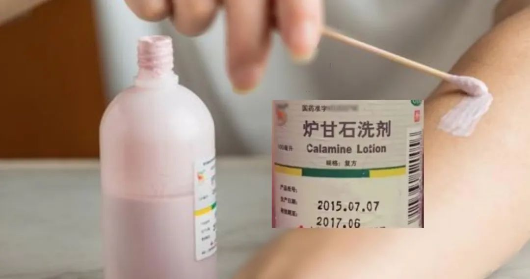 炉甘石洗剂开瓶后多久有效,炉甘石洗剂开瓶了能放多久