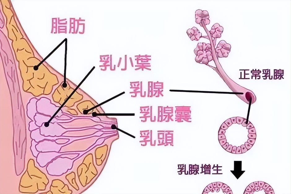 乳腺增生针灸治疗哪些部位,乳腺增生3类的中医治疗方法