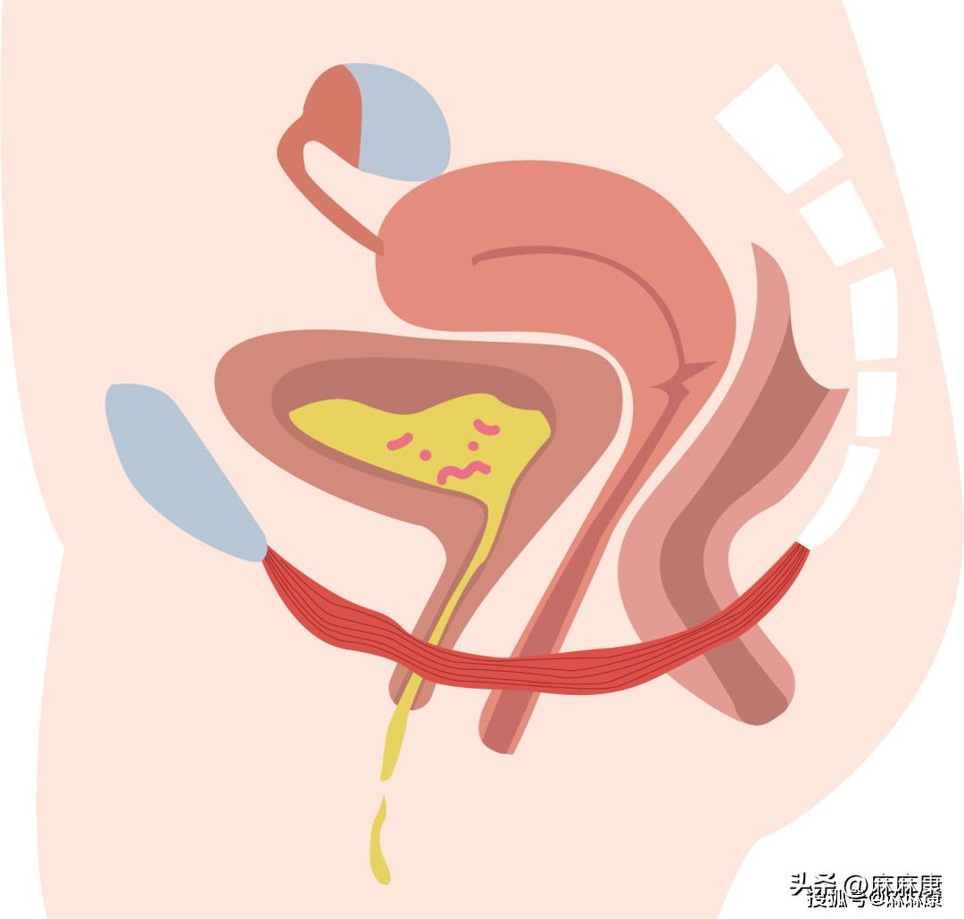 生育对身体的四大损伤！盆底肌常常被忽略
