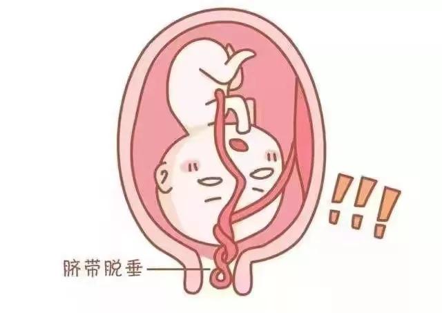 惊心动魄的480秒