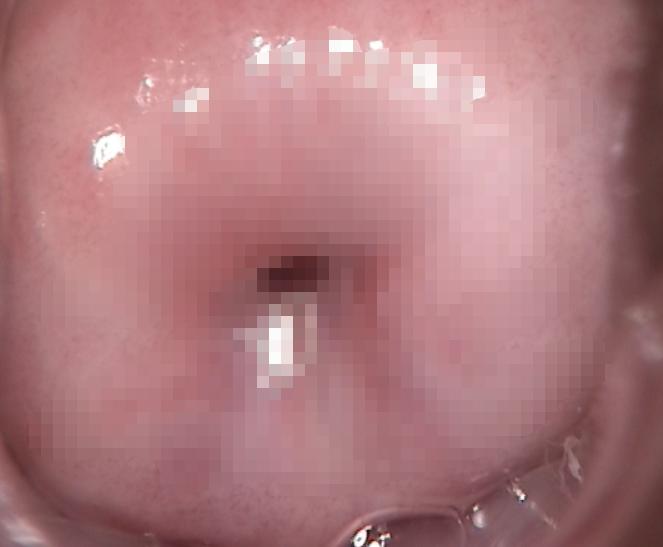 私部瘙痒疼痛是什么原因,私部疼痛瘙痒是什么原因