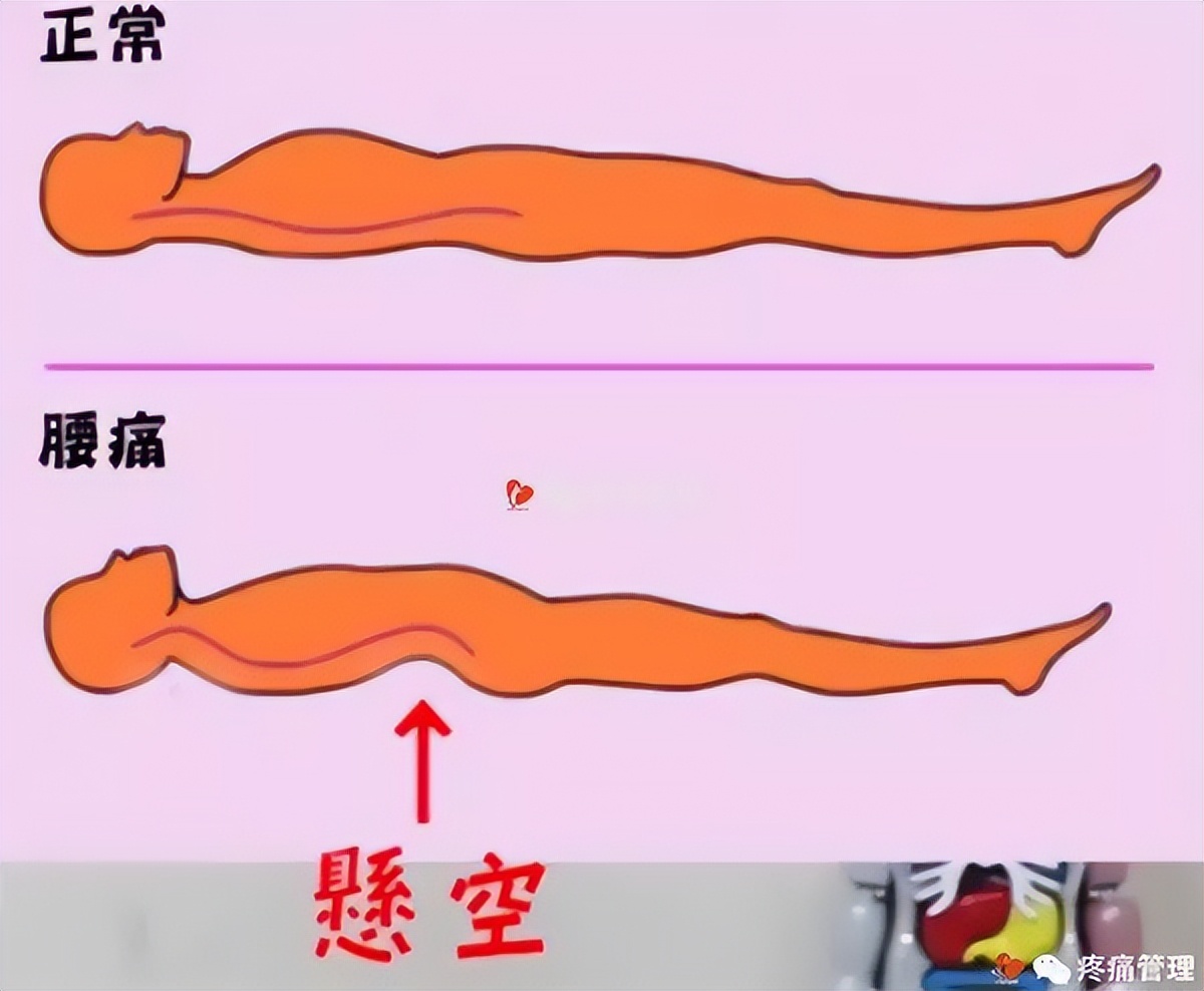 一觉醒来腰痛是肾病吗,一觉醒来腰酸痛是为什么