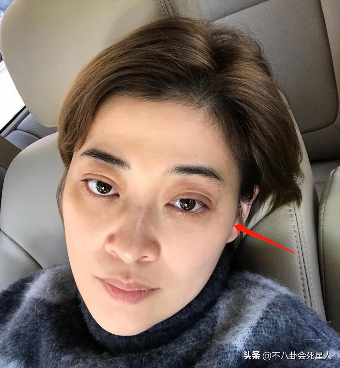 宋轶眼袋,万茜宋轶