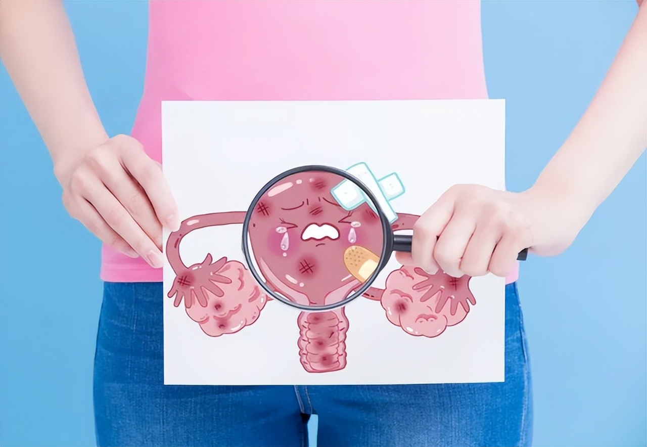 妇科恶性肿瘤一来，就会给出3个“危险信号”，要留心