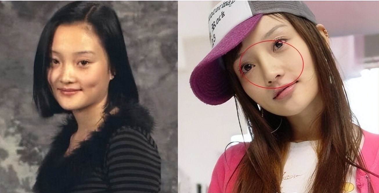 整容了就是不承认,这些女星被质疑整容脸