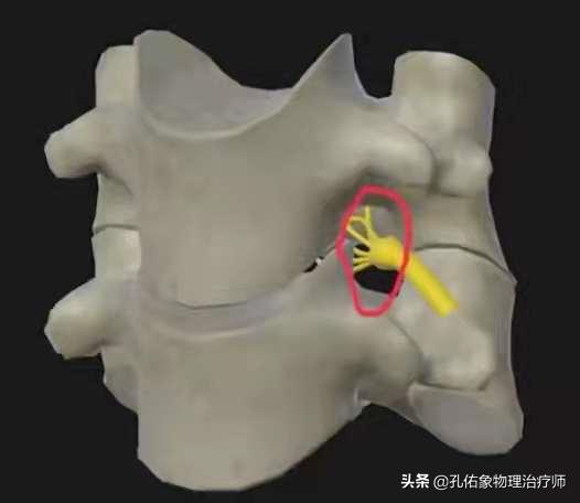 神经根颈椎病的症状和治疗方法,椎动脉颈椎病的症状和治疗方法