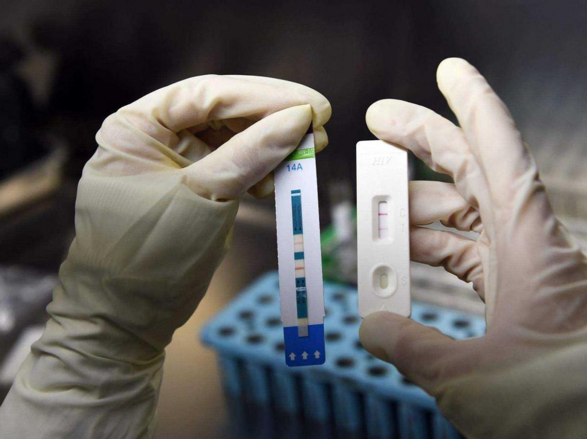 艾滋病后悔药价格,艾滋病后悔