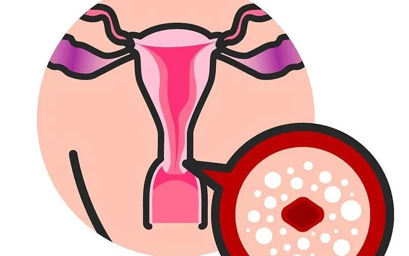 女性腹痛诊断,女子下身检查疼痛难忍