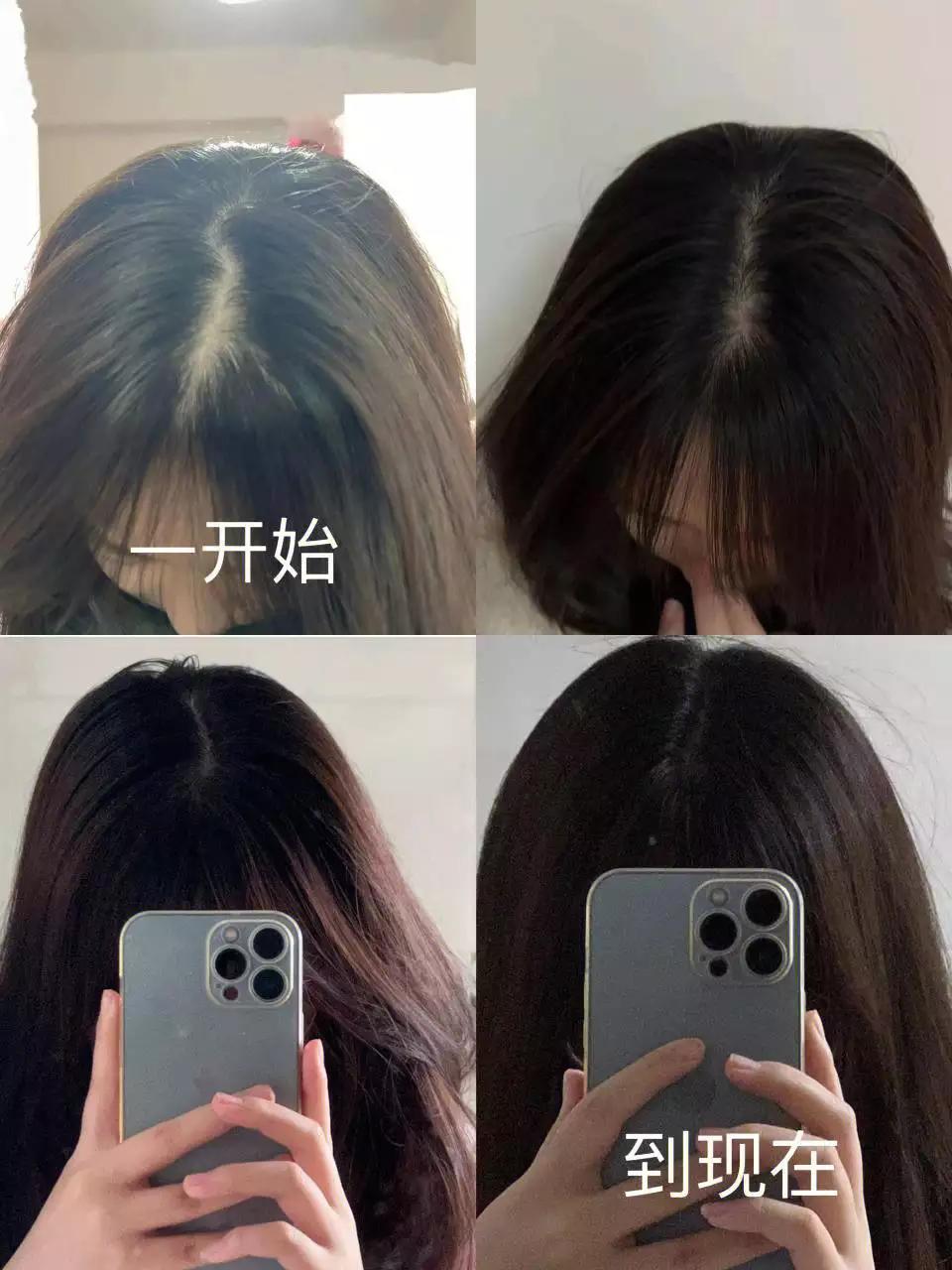 经常熬夜又脱发用什么洗发水好,治疗熬夜脱发洗发水男士