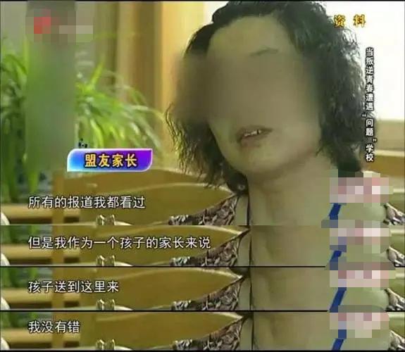 电击恶魔杨永信,杨永信电击的孩子后遗症