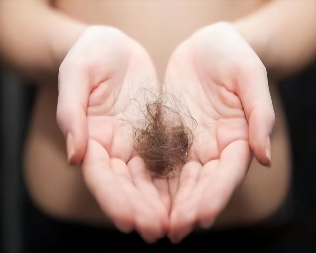 为什么头发浓密眉毛却很稀少,为什么头发是直的身上都是卷毛